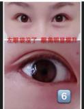 CE Certificate Medical Sodium Hyaluronate/Hyaluronic Acid Gel (For Eye Surgery Viscoelastic)